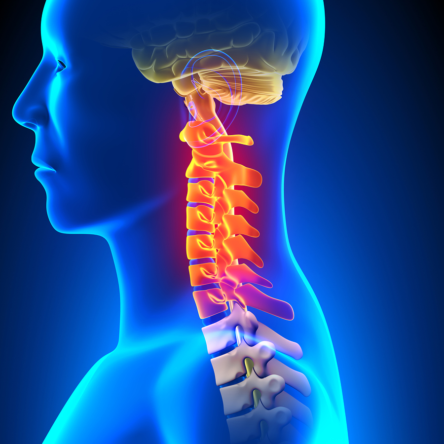 diagram of man with whiplash injury to cervical spine