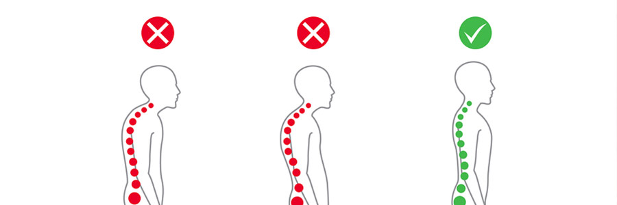 Nerd Neck: How to Fix Forward Head Posture - Absolute Life