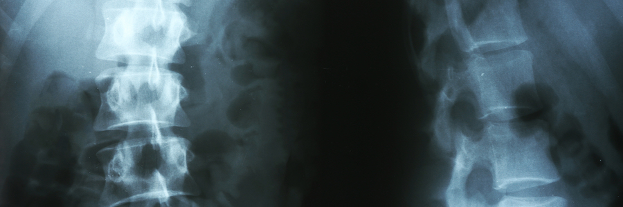 X-ray of human spinal column closeup